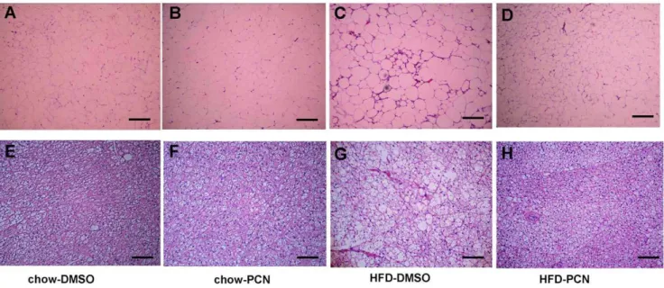 Figure 6. Effect of PCN treatement on lipid accumulation in adipose tissues. At the end of the 7-week treatment, animals were sacrificed, white (A–D) and brown (E–H) adipocyte tissues were collected and stained with H&amp;E