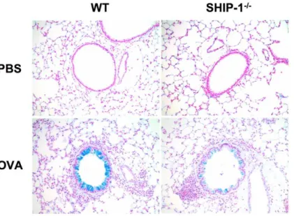 Figure 2. Lung histology and quantitative assessment of mucus metaplasia. (A) Alcian blue staining (20x) of lung sections