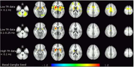Figure 4. White matter functional connectivity. Functional connectivity of the white matter seed in the two lower frequency bands (,0.1 Hz and 0.1–0.25 Hz) in the low-TR (top) and high-TR (bottom) datasets