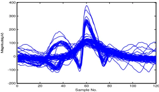 Fig. 2. Segmented EMG signal in segments of 6ms and centered at the maximum peak. 