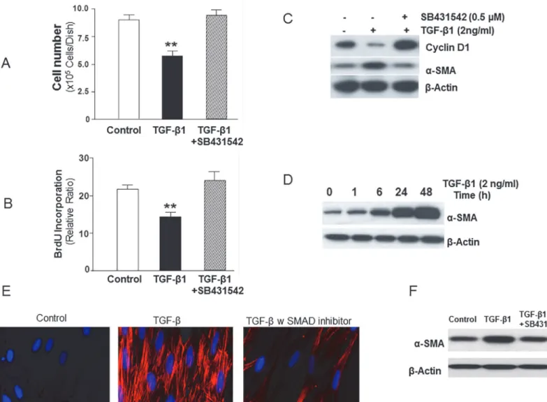 Figure 1. TGF-β1 induces growth suppression in association with induction of myofibroblast differentiation of human lung fibroblasts