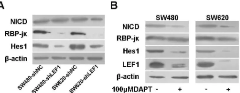 Figure 6.  Effects of LEF1 knockdown on regulation of Notch pathway gene expression.  (A) Western blot analysis of NICD, RBP-jκ and Hes1 expression