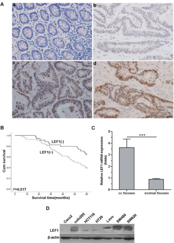 Figure 1.  Expression of LEF1 mRNA and protein in colon cancer tissues, paratumorous colon tissues and colon cancer cell lines