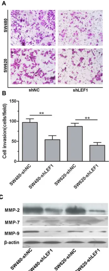 Figure 5.  Effects of LEF1 knockdown on regulation of tumor cell invasion and expression of MMP2 and MMP9 proteins in vitro