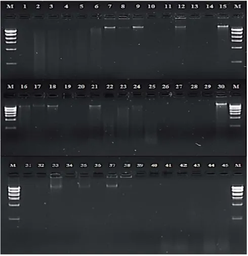 Figura 1 – Quanti icação de DNA genômico em gel de agarose [1%],  corado com brometo de etídio