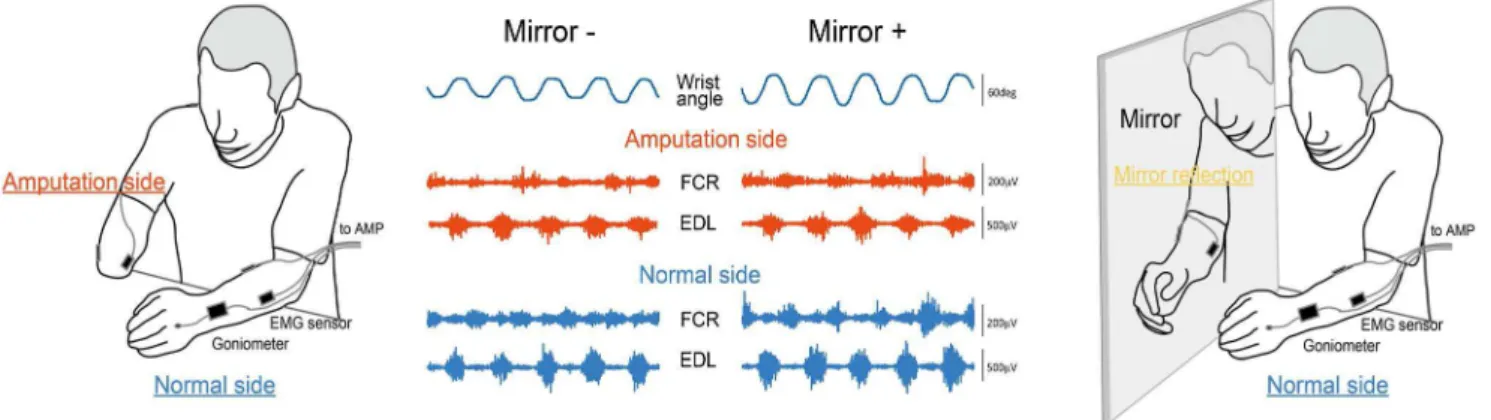 Figure 2. Effect of MVF on VAS (A), ROM (B), EMG activity of FCR (C) and ECR muscles (D)