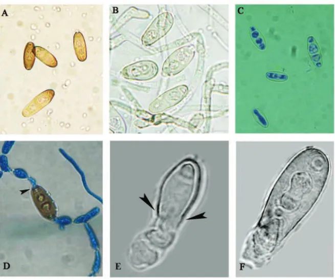 Fig. 3. Morphological changes of Bipolaris spicifera conidia inluenced by Nepeta rtanjensis essential oil: A