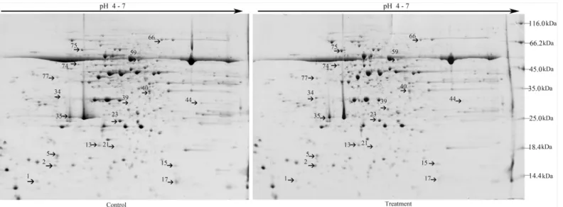 Fig 1. Representative 2-DE gel pattern of soybean leaves at 72 h post-inoculation with B