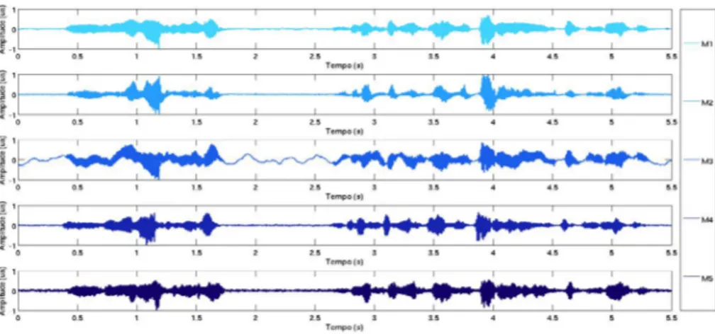 FIGURA 3 – Zoom em um trecho de áudio de 5,5 segundos para exemplificar o  resultado após procedimento de alinhamento dos microfones