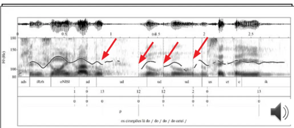 FIGURE 5 – Example 5 soundwave, spectrogram, pitch contour and textgrid