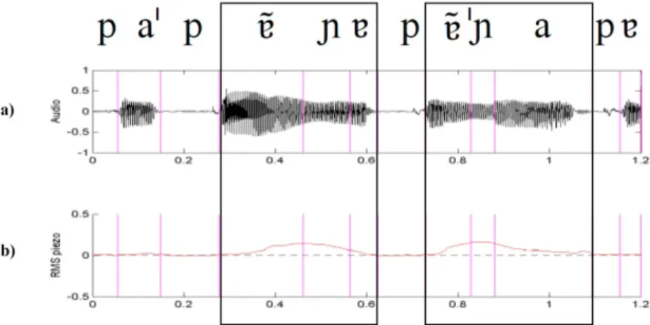 FIGURA 2 - Logatomas [pa)))aa] produzidos por L3, com destaque para as  regiões [))))a Em (a), forma de onda do sinal captado pelo microfone oral;  