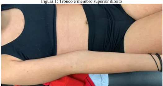 Figura 1: Tronco e membro superior direito  