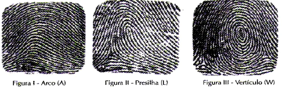 Figura 1: Tipos de desenhos dermatoglíficos. 