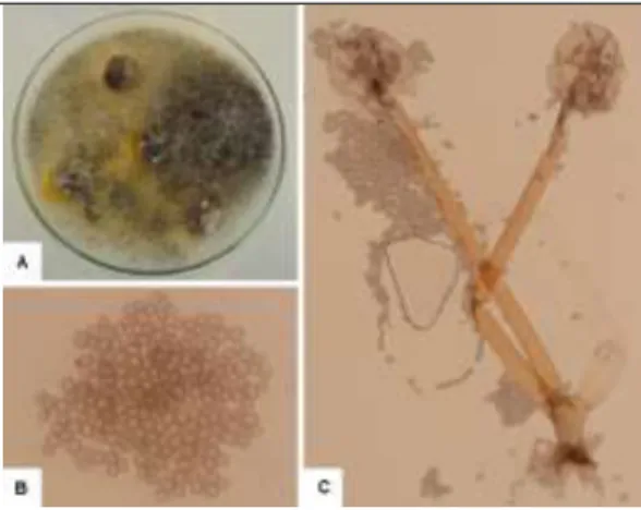 Figura  4.  Rhizopus  sp.;  A:  colônia  de  Rhizopus  sp.;  B:  esporangiosporos;  e,  C  esporangióforos  com  rizóides  em  sua  base  e  columelas  em  formato de guarda chuva (Limeira, SP, 2012)