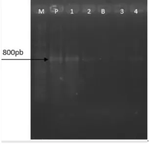 Figura 1. Eletroforese em gel de agarose a 2% com produtos da PCR para identificação da espécie Listeria monocytogenes