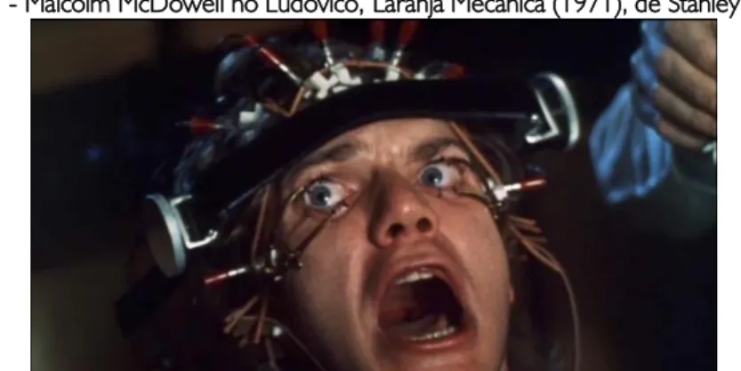 Figura 1 - Malcolm McDowell no Ludovico, Laranja Mecânica (1971), de Stanley Kubrick. 