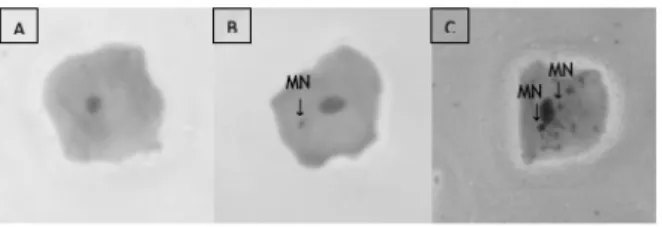 Figure 1 - (A) A epithelial cell from the oral mucosa of the sample studied  without the presence of micronucleus