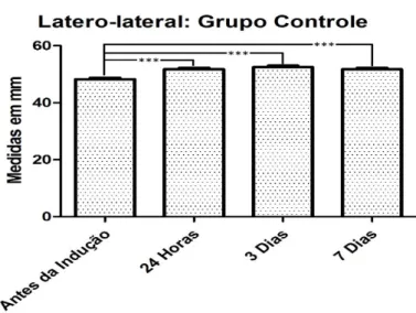 Figura 2: Resultados expressos em média e desvio-padrão; pós-teste de Turkey (*p&lt;0,05; **p&lt;0,01; ***p&lt;0,001)