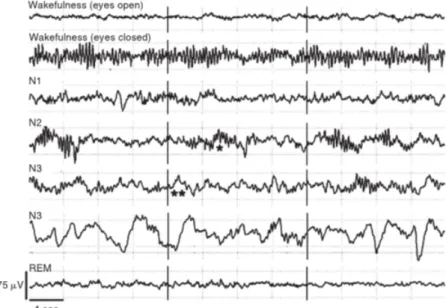 Figure 2 .: Human EEG recordings during wakefulness and sleep stages ( ∗ sleep spindles; ∗∗ slow wave) [ 22 ]