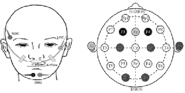 Figure 6 .: Example of a standard PSG montage sensors that are located on the head of the patient.