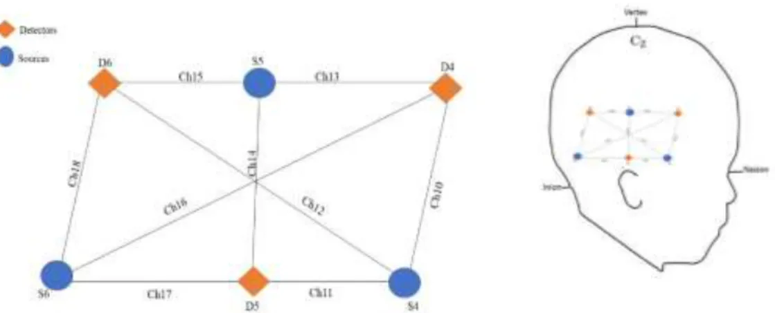 Figure 3. Example of the array and positioning of the probe. 