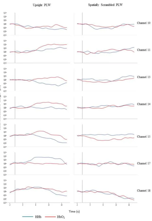 Figure 4: Averaged mean concentration changes(µm) in HbO2 and HHb across all subjects  per channel.