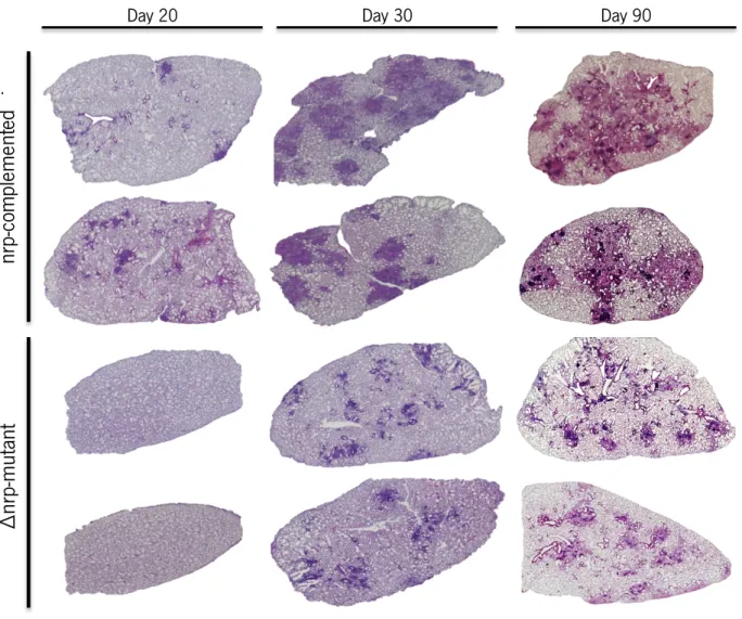 Figure  7:  Animals  infected  with  the  ∆nrp-mutant  or  the  nrp-complemented  strain  presented  different  immunopathology in  the  lungs