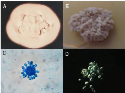 Figure 2.  Paracoccidioides brasiliensis  mycelia and yeast forms. Macroscopic characteristics of mycelial (A) and yeast form  (B); Multiple budding cells observed in the yeast form (C); and Differential Interference Contrast (DIC) observation of yeast  ce