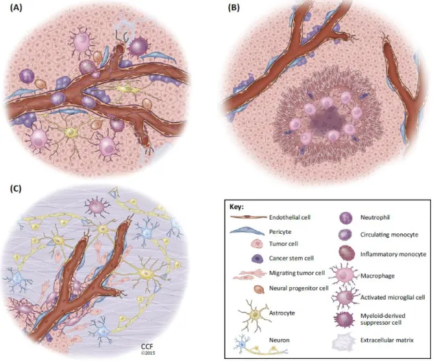 Figure 1.3. - Tumor niches of Glioblastoma -  Glioblastomas can present different niches, that present specific  features and different intra-cellular composition