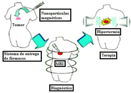 Figura 1.4: Esquema do uso de nanopartículas magnéticas como estratégia terapêutica,  para diagnóstico e tratamento simultâneo [25]