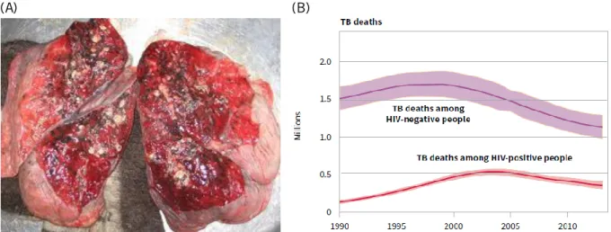 Figure 1. Pathology and death rate of human TB. (A) Gross appearance of TB dissemination in the lungs of a 35-year  old male individual infected with HIV [8]