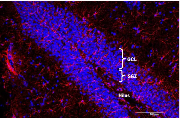 Figure 8.  Total number of astrocytes analysis on the hippocampal DG.  This image represents an immunostaining for GFAP  (red), showing several astrocytes present in the hippocampal DG