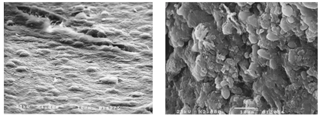 Figure 4 Photomicrographs captured by scanning electron microscopy of biofilms developed on the VAP ETT  [16]