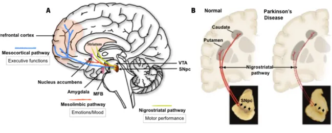 Figure 1. Neuropathology of Parkinson's disease. 