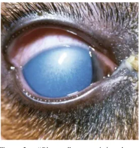 Figura  2  -  “Blue-eye”  característico  da  HIC,  causado  por  dano  viral  e  imunológico  ao  endotélio