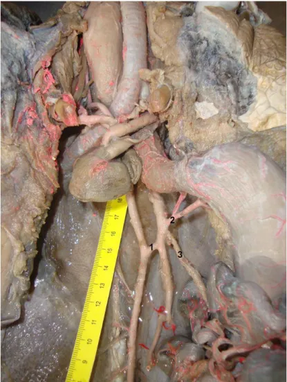 Figura 3: Artérias da base do coração: 1 - Anastomose; 2 - Artéria  celíaca; 3 - Artéria mesentérica cranial