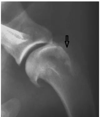 FIGURA 5:   Imagem radiográfica de ombro esquerdo, projeção mediolateral, de cão  portador  de  tenossinovite  bicipital