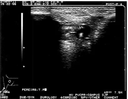 Figura  8  -  Ultrassonografia  da  ATM  esquerda  de  um  equino  em  ponto  transverso  lateral