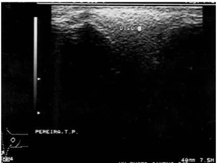 Figura  5  –  Ultrassonografia  da  ATM  esquerda  de  um  equino  em  ponto  transverso  lateral