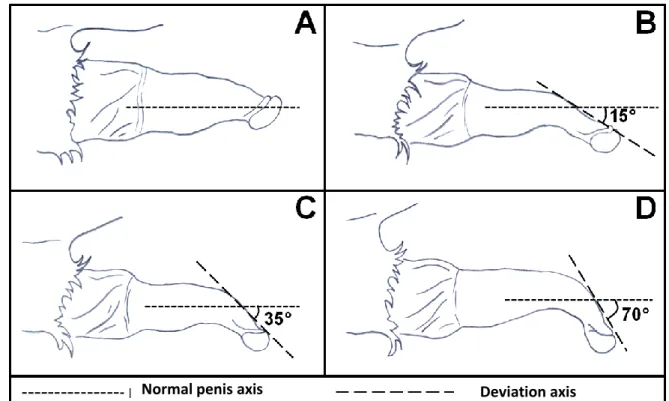 Figure  2  –  Representation  of  different  degrees  of  ventral  penile  deviation.  (A)  normal  direction, (B) mild deviation, (C) moderate deviation, (D) intense deviation