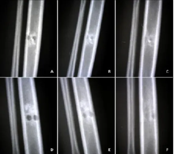 FIGURA  03:  Imagens  radiográficas  em  posição  médiolateral,  ilustrando  o  aspecto  pós operatório  imediato (A  e  D),  30  dias  (B  e  E)  e  60  dias  (C  e  F)  após  enxertia  xenógena  e  autógena,  respectivamente