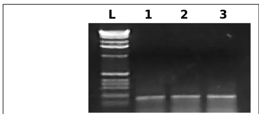 Figura  2.  Análise  dos  produtos  obtidos  por  amplificação  de  PCR  de  segmento  do  gene  16SrDNA da Bartonella sp