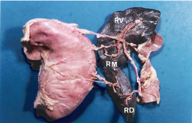 Figura 2- Baço do gato dissecado, mostrando a artéria lienal ( L ), distribuindo ramos para  as regiões Dorsal ( RD ), Média ( RM ) e Ventral ( RV )