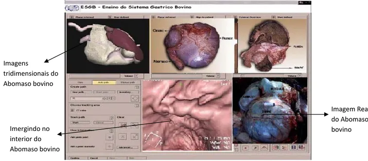 Figura 4 – Comparações: (a) Imagem do aparelho do estomago real; (b) Visualização do estomago em  3D.