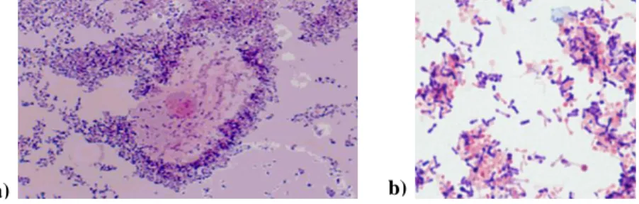 Figure  1.4. a)  Epithelial  cell  totally  covered  by  Gram-positive  bacteria  (clue  cell),  G