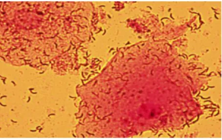 Figure  1.7.  Gram  staining  of  vaginal  smear  of  clinical  sample  that  we  received  shows  curved  rods,  morphotypes associated with Mobilluncus spp