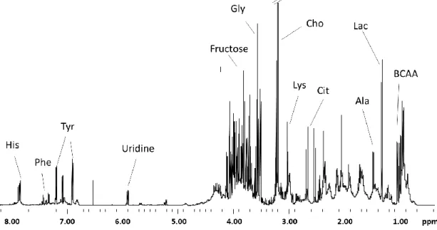 Figure 3. Representative  1 H NMR spectrum of seminal plasma. Some major metabolites are indicated according  to  Table  1