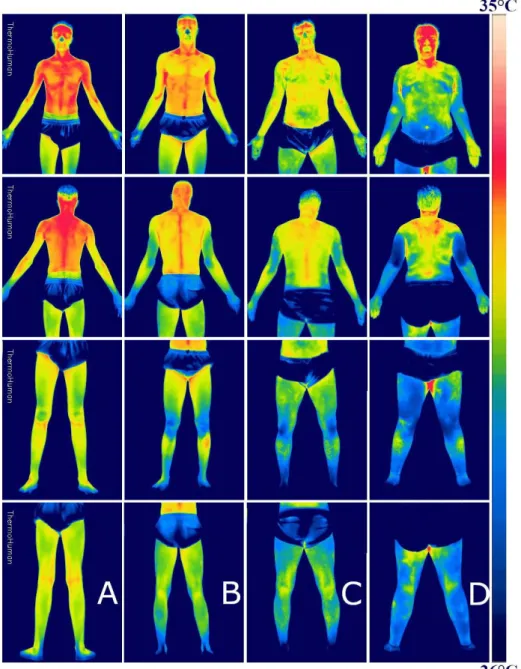 Figure 2. Thermograms of all four analyzed participants, upper and lower body, in  front and rear views