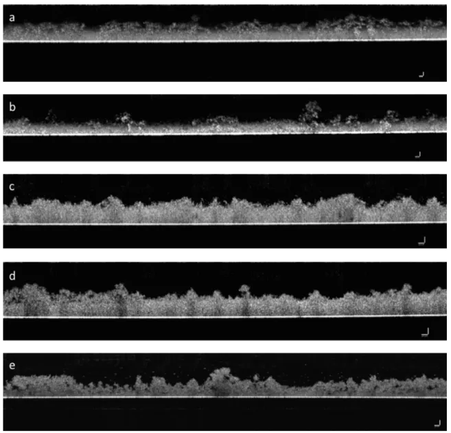 Figure  3.1  Optical coherence tomography (OCT) images showing a vertical section of 48 h biofilms  that  grown  under  steady  conditions