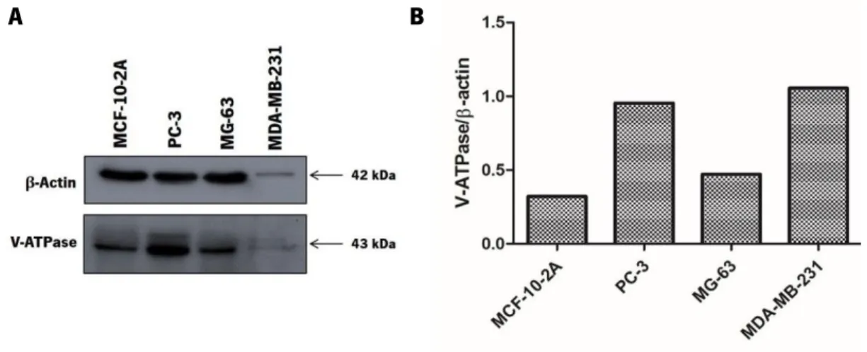 Figure III.2. V-ATPase expression levels in highly metastatic cancer cell lines MDA-MB-231, PC-3 and MG-63  in comparison with the non-tumorigenic breast cell line MCF-10-2A